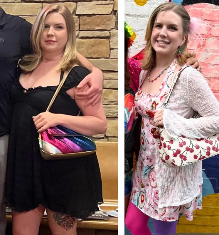 Tawny — before and after MovaBio research protocol